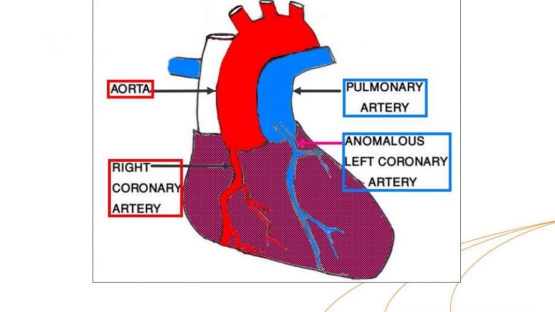 Webinar - Myocardial Perfusion Scintigraphy in Paediatric Cardiology