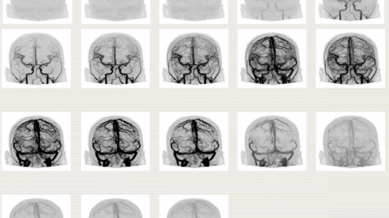 Diagnostic Radiology Physics